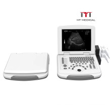 12 Inch Lowest price professional laptop portable best B/W ultrasound machine for sale